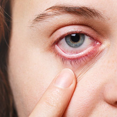 Persistent eye pain or redness