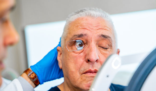 Macular Degeneration